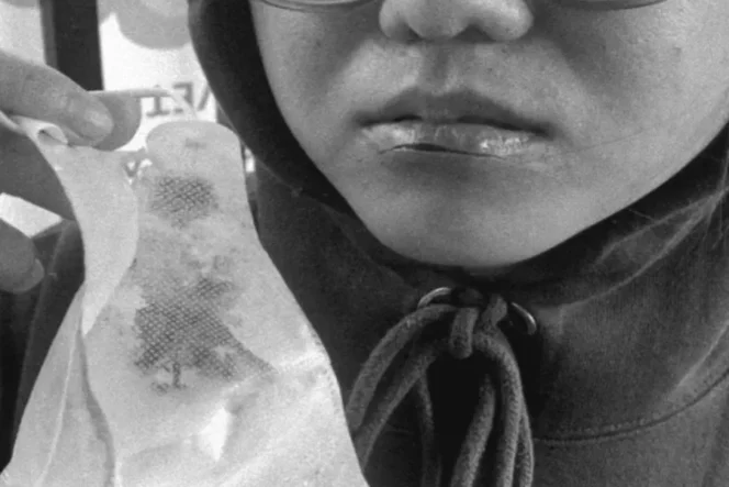 
					Ancaman Tak Terlihat di Langit Sidoarjo: Ketika Senar Layangan Mengoyak Wajah Pengendara