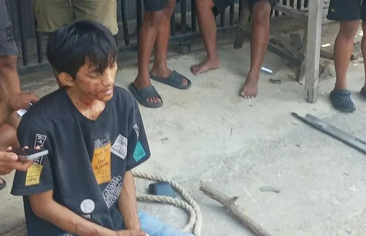 Senyapnya Bahaya Kantuk di Balik Kemudi: Kisah Patah Kaki Kernet Truk di Tanjung Bumi Bangkalan